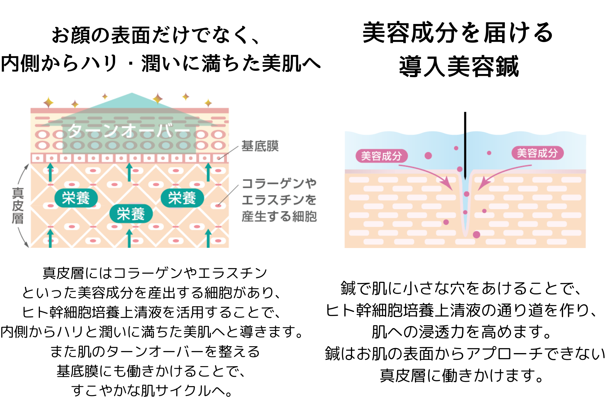 ねこのひげではお肌に美容成分を届けるための導入美容鍼も行っています。 そうすることでお肌に美容液が浸透し、お肌のターンオーバーが正常になり、さらにお肌が綺麗になっていきます。