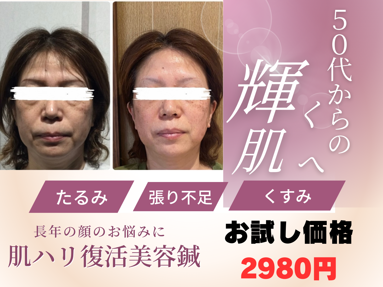 玉名 玉東町の美容鍼サロン ねこのひげ 45歳〜60歳の顔の張り不足たるみがコンプレックスになっている人のための美容鍼サロン
熊本 美容鍼
玉名 美容鍼