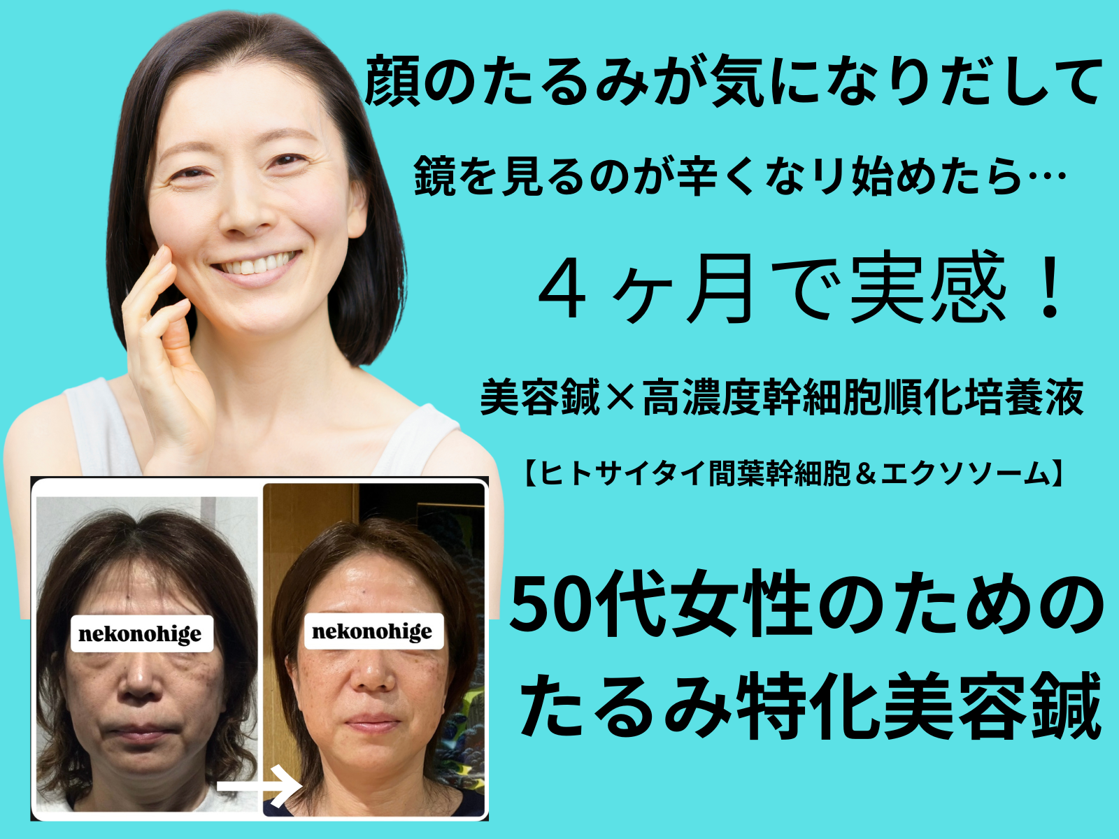 46歳から59歳女性の顔の悩みはコレです。 玉名 玉東町の美容鍼サロン ねこのひげ 45歳〜60歳の顔の張り不足たるみがコンプレックスになっている人のための美容鍼サロン 熊本 美容鍼 玉名 美容鍼