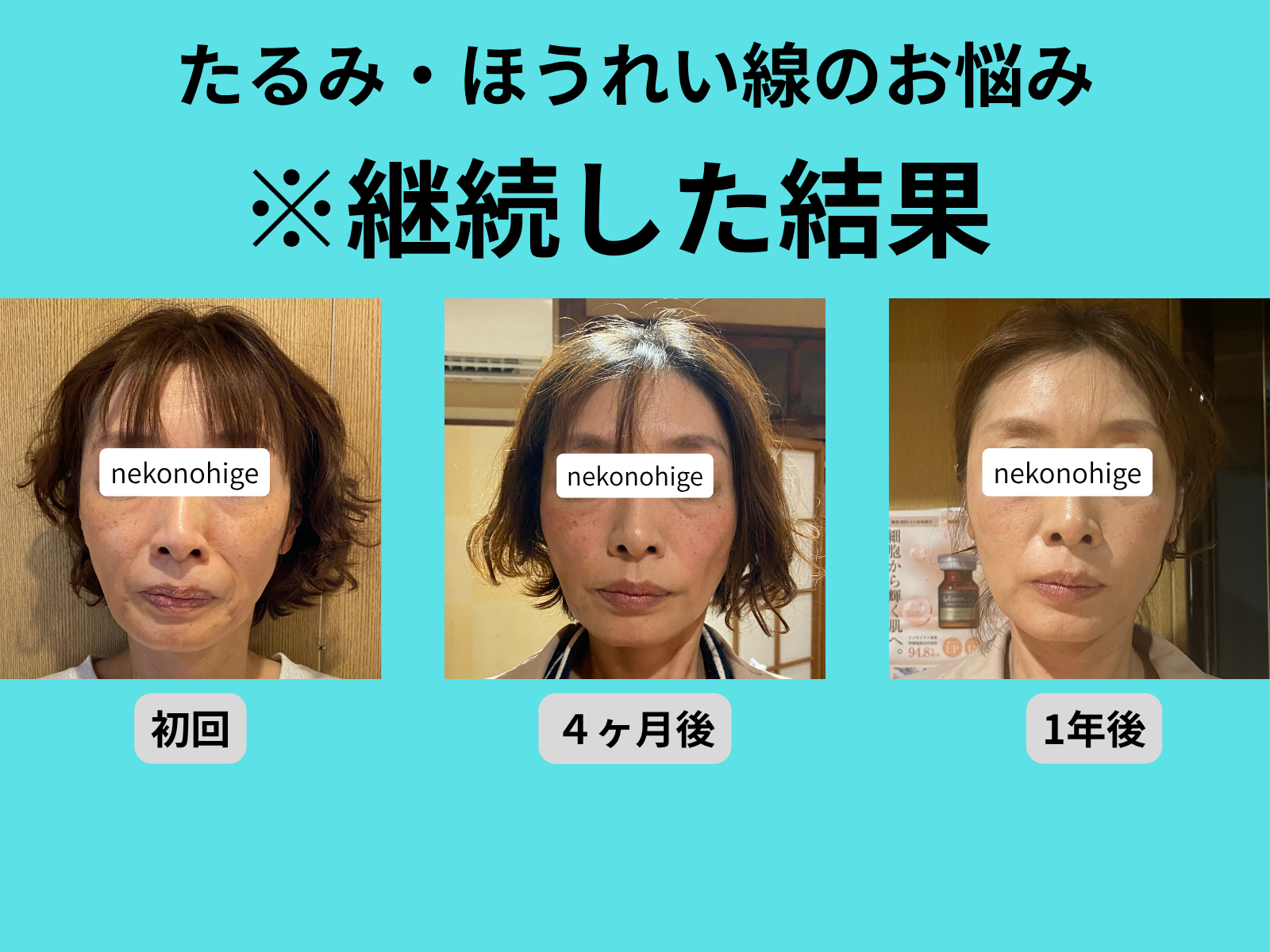 初回の来店から一年通われたお客さんの顔の変化