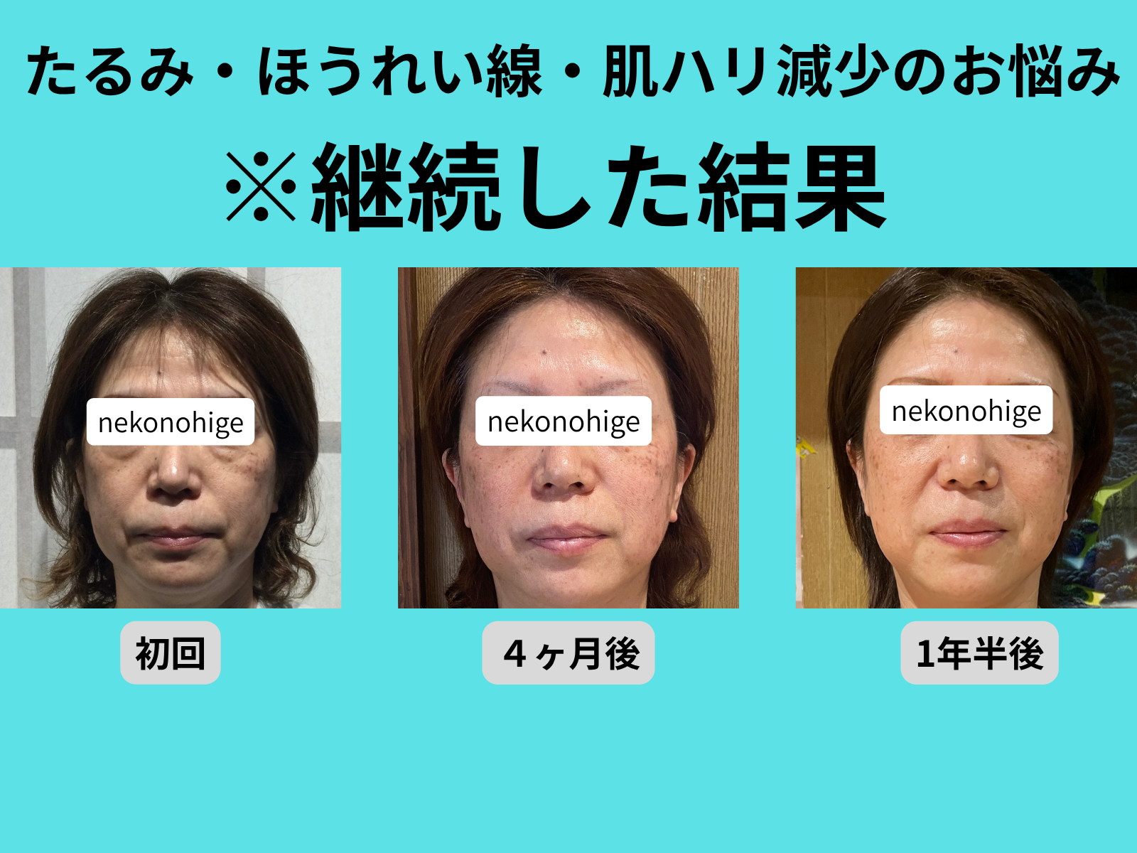 初回の来店から一年半通われたお客さんの顔の変化