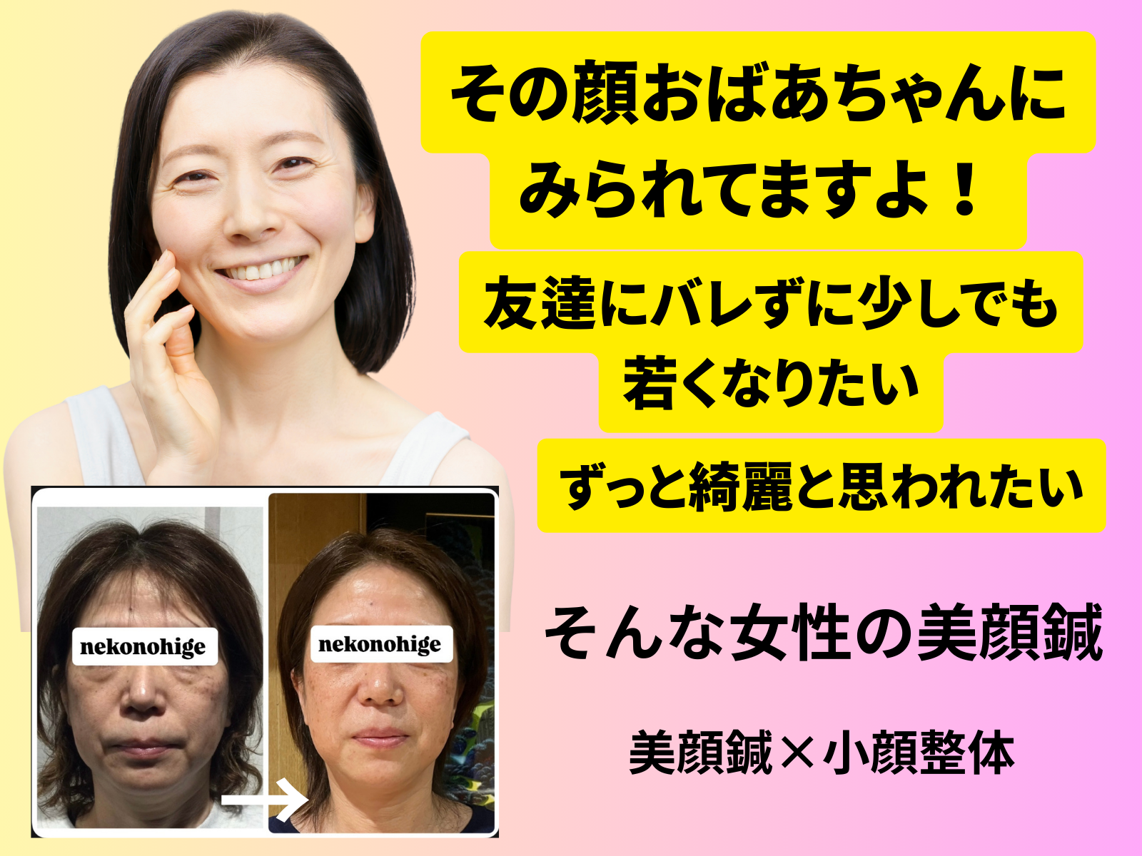46歳から59歳女性の顔の悩みはコレです。 玉名 玉東町の美容鍼サロン ねこのひげ 45歳〜60歳の顔の張り不足たるみがコンプレックスになっている人のための美容鍼サロン 熊本　美容鍼 玉名　美容鍼